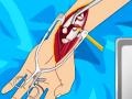 Joc Arm surgery 2